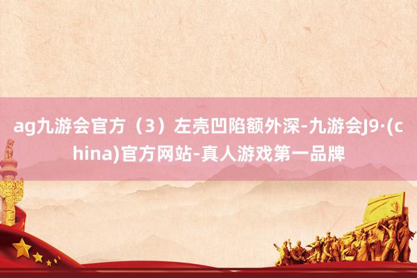 ag九游会官方（3）左壳凹陷额外深-九游会J9·(china)官方网站-真人游戏第一品牌